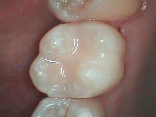 3 OL after