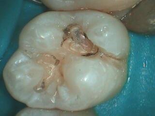 Intra-Oral_05-29-14