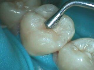 Intra-Oral_05-29-14_0004