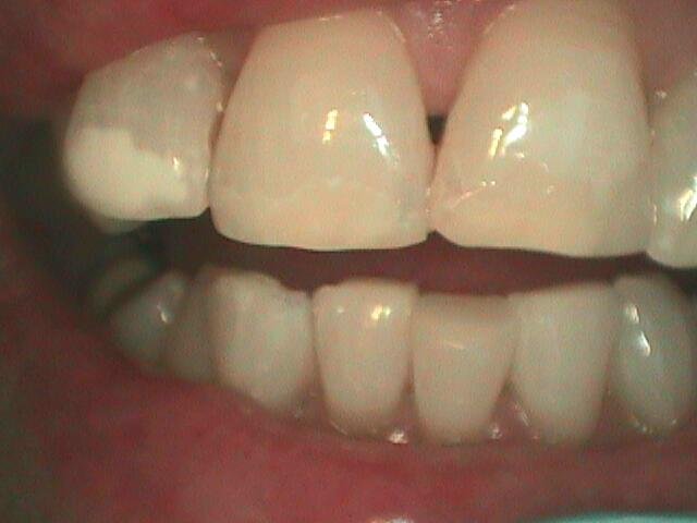 fill after bevel